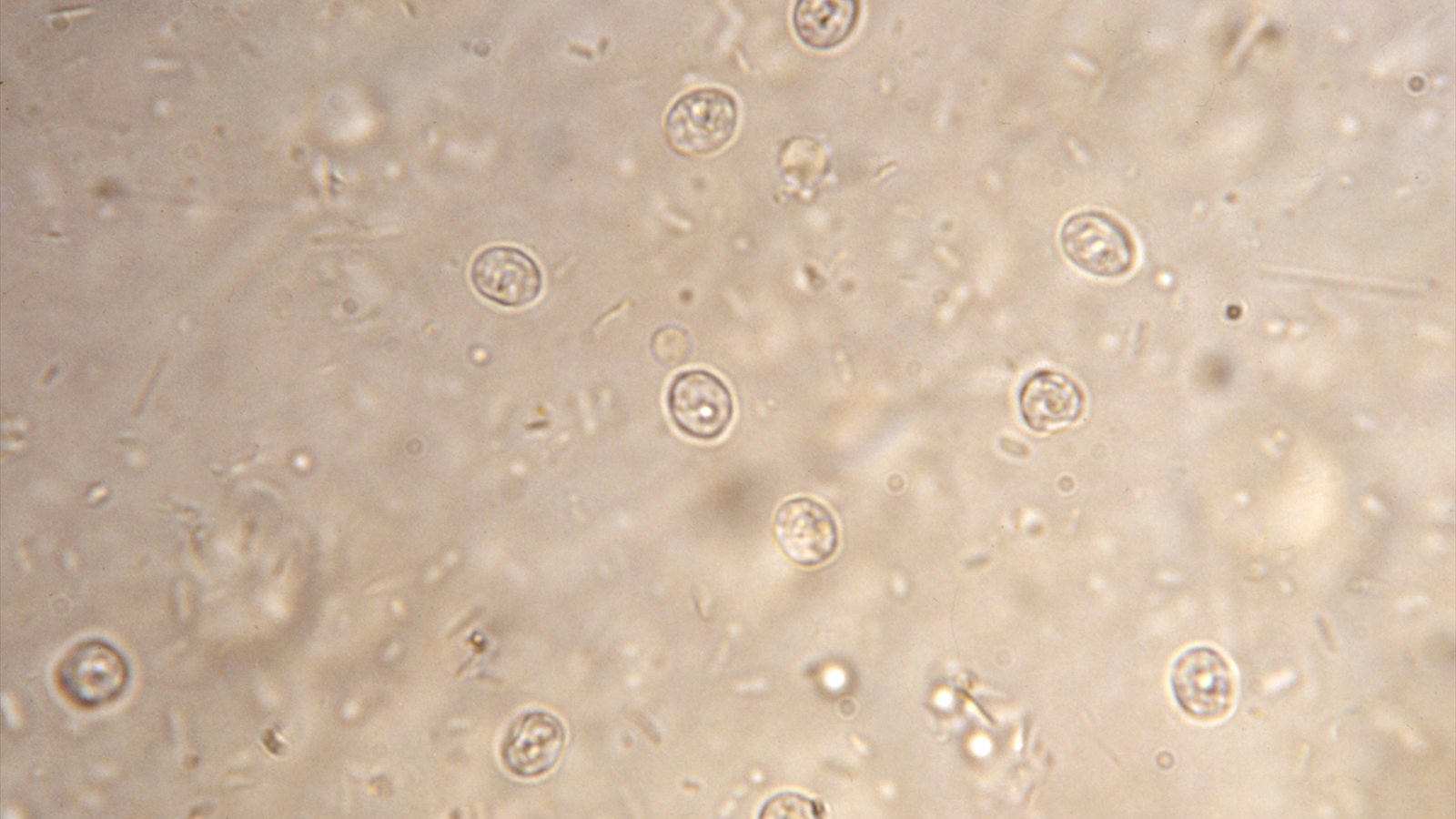 Numerous small round Cryptosporidium parvum organisms are scattered across a pale microscope field.