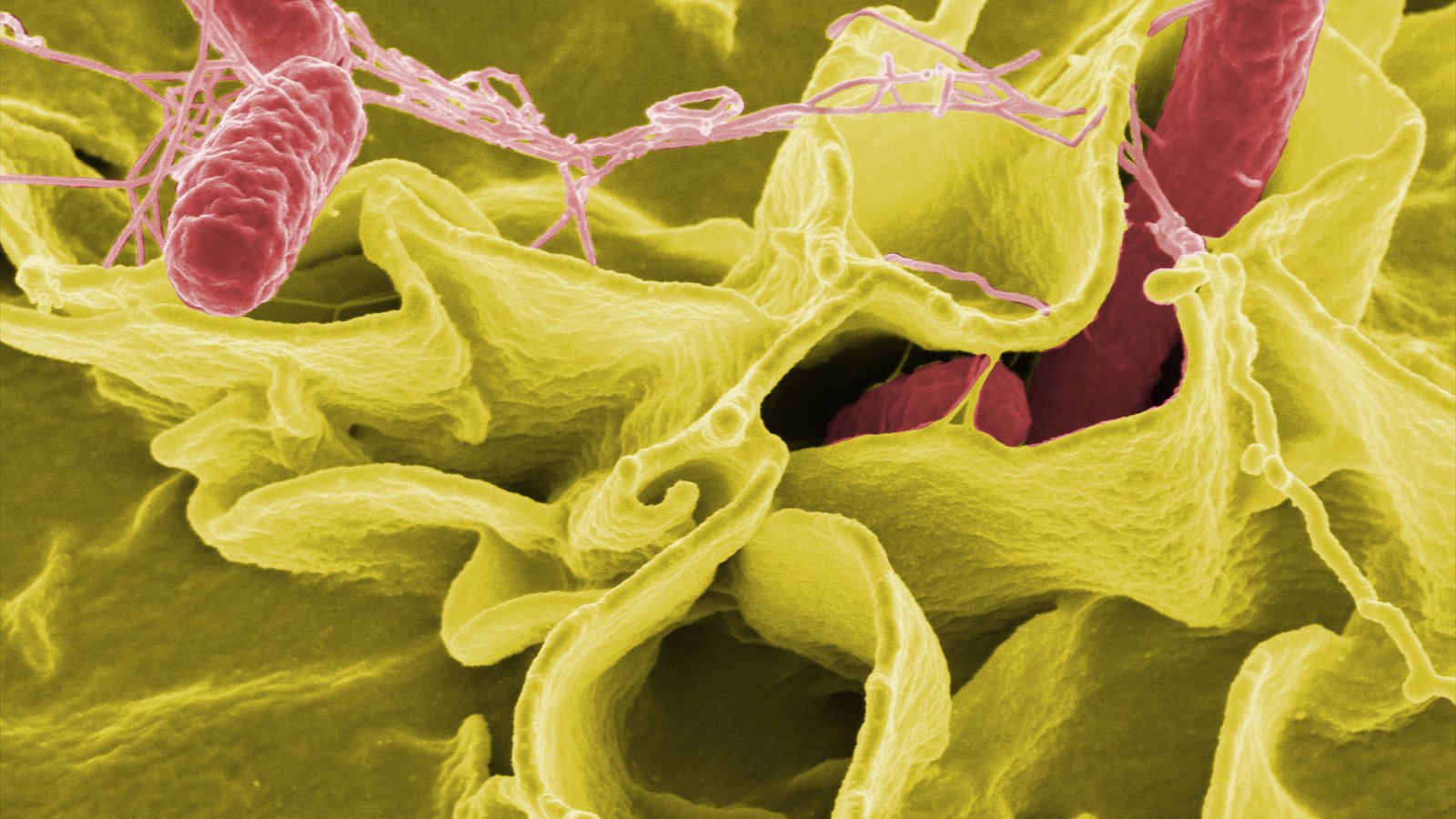 Color-enhanced red Salmonella bacteria cluster across the surface of a cultured human cell in an electron micrograph.