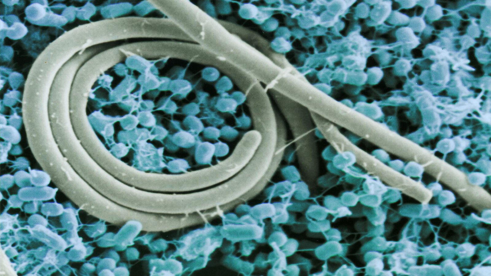 Colorized SEM (scanning electron micrograph) of the foodborne pathogen Salmonella enteritidis. Blue is growth medium. Picture is colored in false colors to illustrate difference. Photo by Jean Guard, ARS.