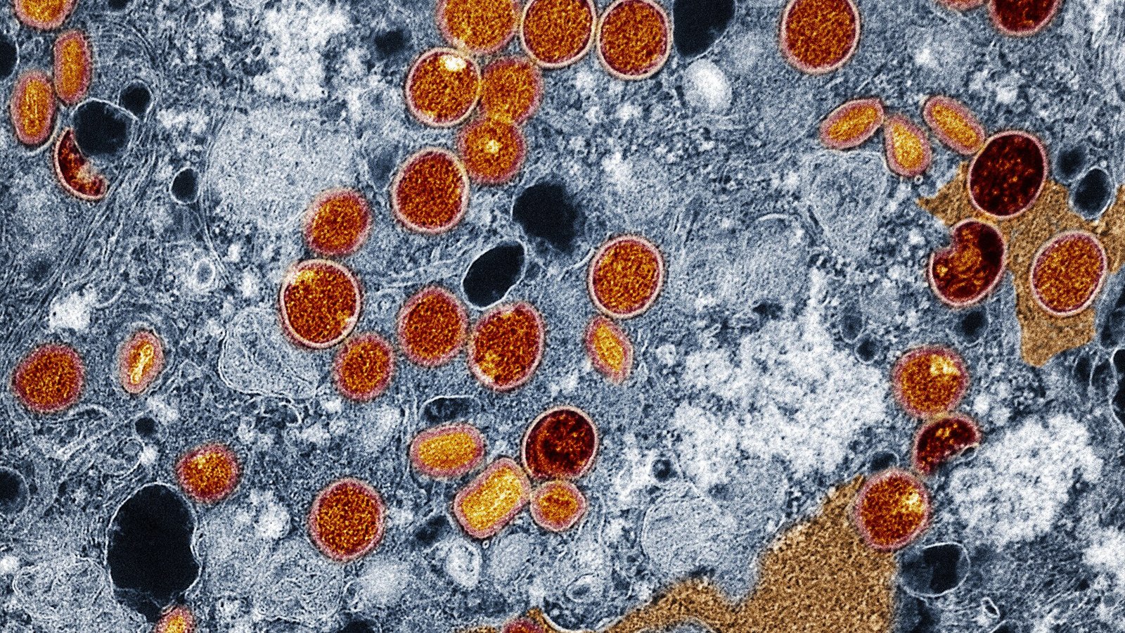 Colorized transmission electron micrograph of mpox virus particles (red and yellow) found within infected VERO E6 cells (blue). The virus particles are in various stages of maturity, which accounts for differences in…