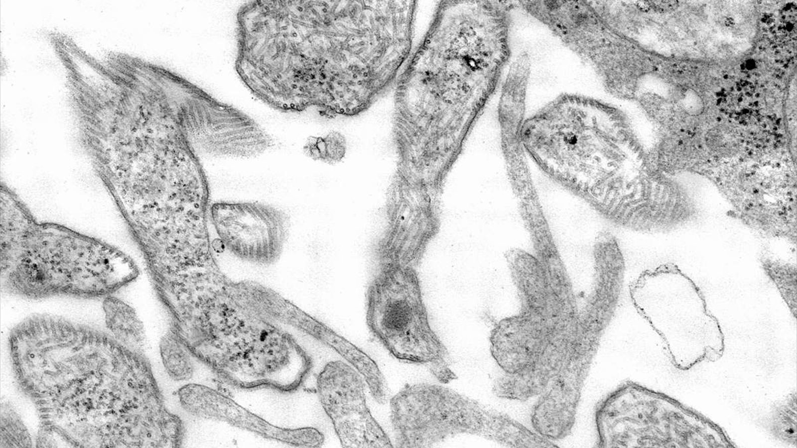 A transmission electron micrograph shows many rounded mumps virus particles inside a cultured cell.