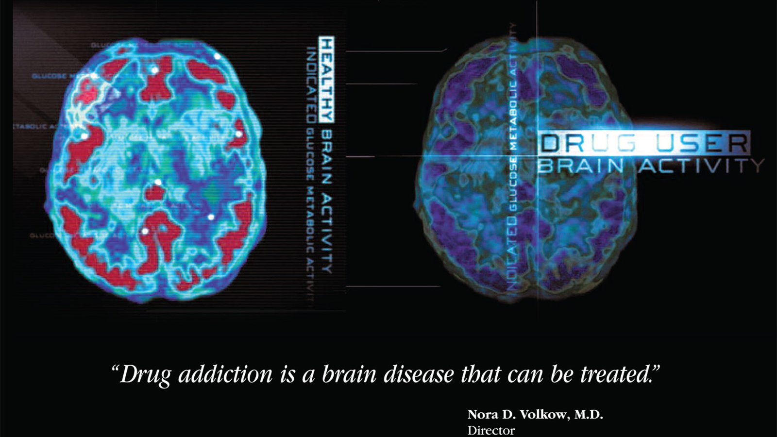 A grid of medical brain scans uses warm colors to show different levels of activity.